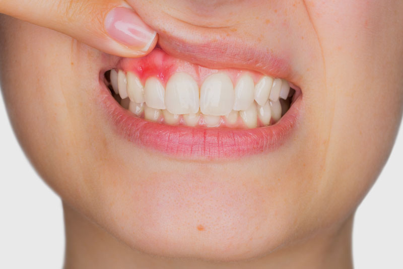 dental patient with gum disease