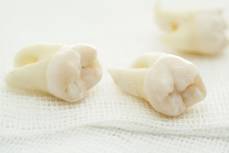 tooth models